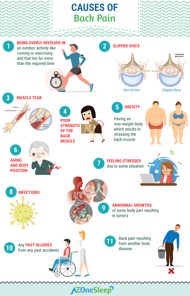 Causes of back pain