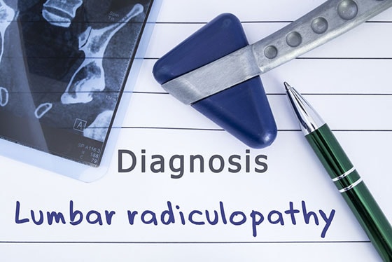 Lumbar Radiculopathy